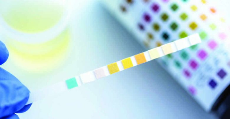 test urine