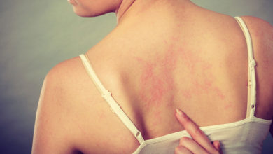 peau