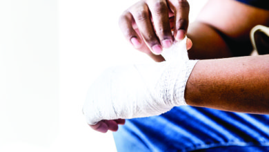 comment soigner brulure legere