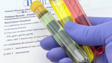 VIH des chercheurs ont éliminé le virus du sida