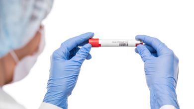 Covid-19 : un professionnel de santé testé positif