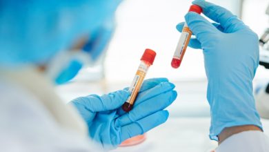 Coronavirus et groupe sanguin : le groupe A serait-il désavantagé face l’infection ?