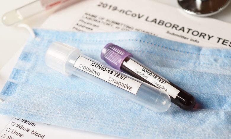 Photo de Covid-19 : 1.2 million doses de molnupiravir commandées par la Santé